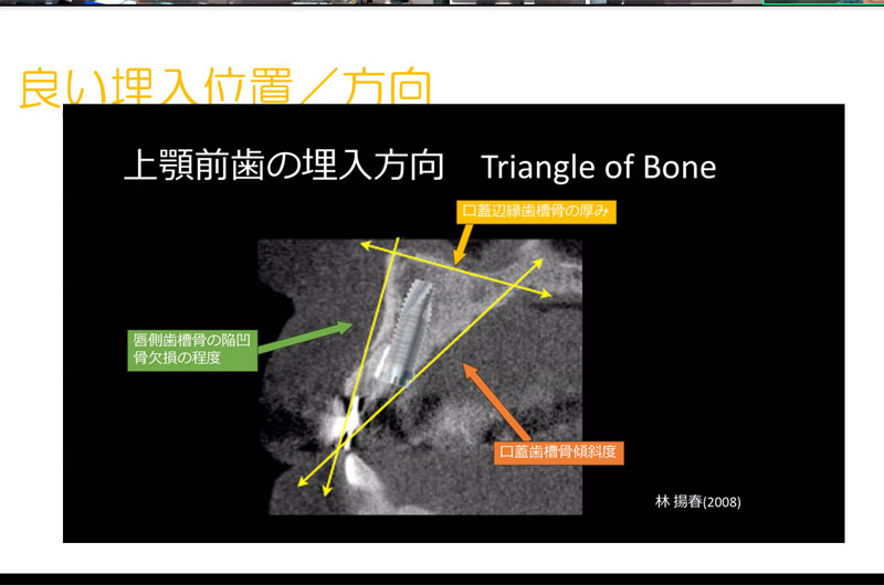 第1回 インプラント症例検討会写真03