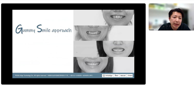 第5回 Invisalign Clinical essentials写真02