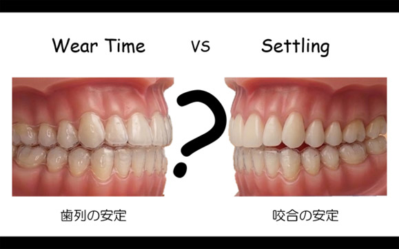 Invisalign Clinical Essentials 第8回写真02