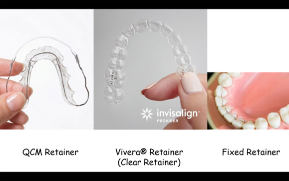 Invisalign Clinical Essentials 第8回写真03